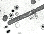 Bacillus anthracus
