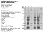 Phast Plate Gel image