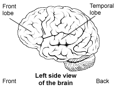 Left side view of the brain showing the temporal lobe and the frontal lobe