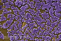 MRSA Bacteria