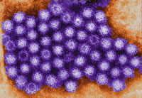 Norovirus