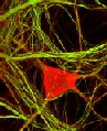 Photo of a neuron stained red for MAP with axons stained yellow for TAU