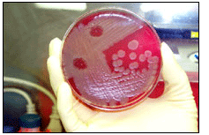 Petri Dish