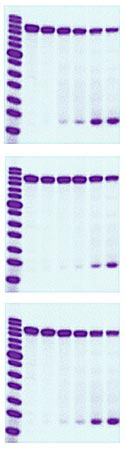 The number and intensity of the dash-shaped marks in the lower right corner of these DNA profile patterns indicates that normal cells (top) are more active in removing damaged DNA than two different lines of prostate cancer cells (center and bottom).
