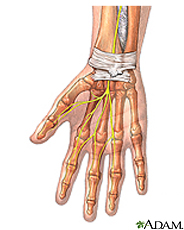 Illustration of the wrist anatomy