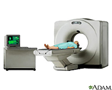 Illustration of a patient in a CT scanner