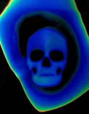 Thermal image of a skull
