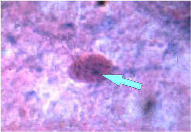 Enlargement of a Negri body in Sellers stained brain tissue