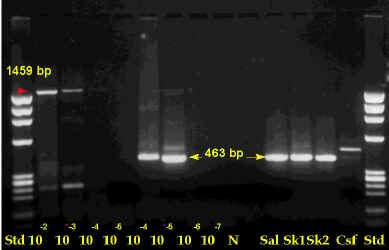 PCR test result for rabies virus