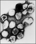 Transmission electron micrograph of rubella virus.