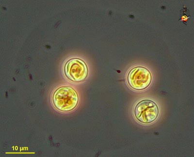 Stichogloea doederleinii