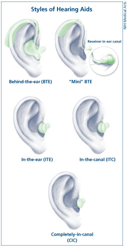 Hearing Aid Types