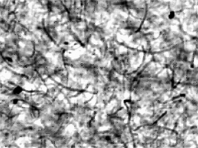 confoncal microscope image of carbon nanotube/polypropylene composite