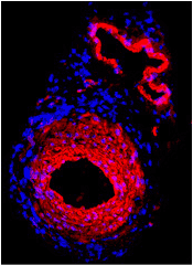 Bone Marrow derived cells reconstitute vascular lesions during vascular repair and remodeling.