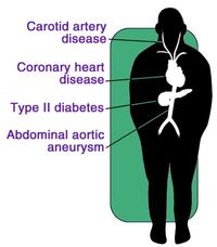 Graphic of organ systems affected by absolute risk