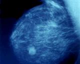 picture of a mammogram