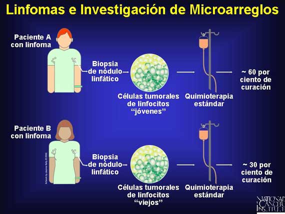 Linfomas e Investigación de Microarreglos