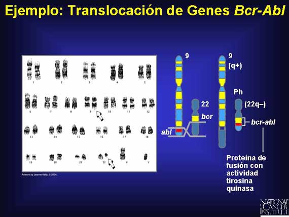 Ejemplo: Translocación de Genes <I>Bcr-Abl</i>