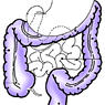 Illustration highlighting location in abdomen of colon.