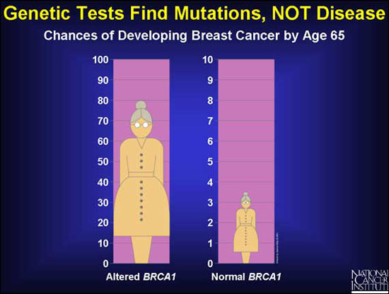 Genetic Tests Find Mutations, NOT Disease - Chances of Developing Breast Cancer by Age 65 - women with altered BRCA 1 have an 80 percent chance; women with normal BRCA1 have between a 3 and 4 percent chance.