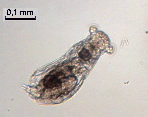 Cupelopagis vorax photo courtesy of MicrOscOpies