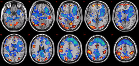 Image of brain scans