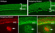 A mutation in the Hedgehog signaling pathway results in extra hair cells in the cochlea.