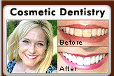 Cosmetic Dentistry