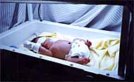 Baby with jaundice getting treatment at home from phototherapy unit