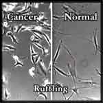 split screen of cell growth, with cancer cells shown on the left and normal cells shown on the right
