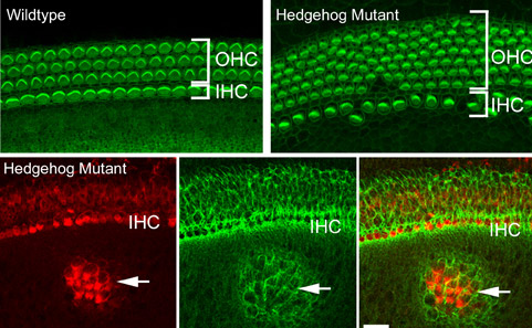 A mutation in the Hedgehog signaling pathway results in extra hair cells in the cochlea.