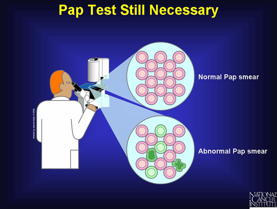 Pap Test Still Necessary