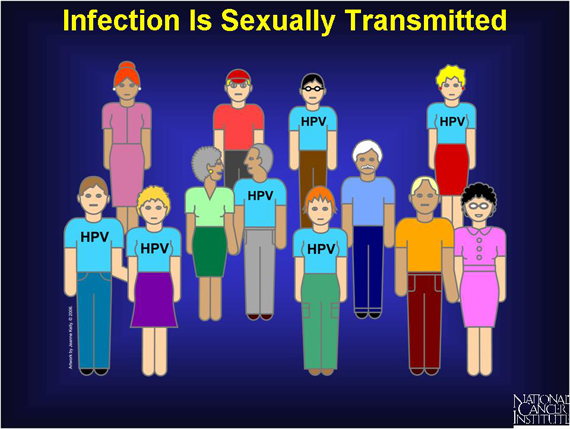 Infection Is Sexually Transmitted