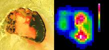 Io's Tupan Caldera in Infrared