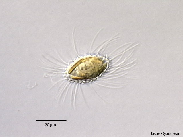 Mallomonas sp.