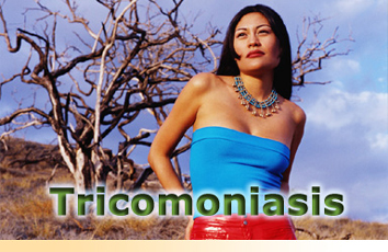 Tricomoniasis