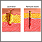 Laceration versus puncture wound