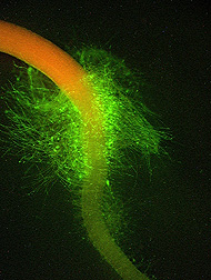 Listeria monocytogenes on this broccoli sprout shows up as green fluorescence: Click here for full photo caption.