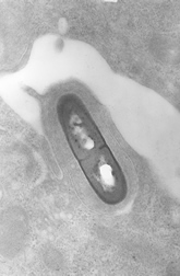 Electron micrograph of a Listeria bacterium in tissue.