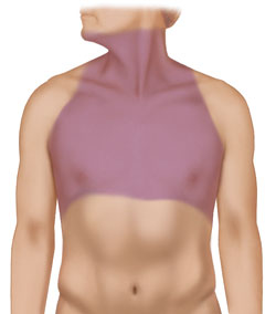 Radiation to the shaded area may cause throat changes.