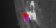 The 2.2MeV gamma-ray emission is prominent.