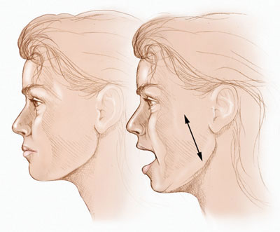 Exercise your jaw 3 times a day.