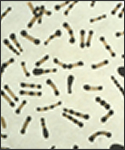 A photomicrograph of Corynebacterium diphtheriae taken from an 18 hour culture, and using Albert's stain.