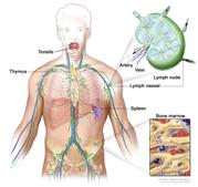 Lymph system; drawing shows the lymph vessels and lymph organs including the lymph nodes, tonsils, thymus, spleen, and bone marrow.  One inset shows the inside structure of a lymph node and the attached lymph vessels with arrows showing how the lymph (clear fluid) moves into and out of the lymph node. Another inset shows a close up of bone marrow with blood cells.