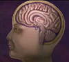 How Alzheimer's Affects Neurons in the Brain