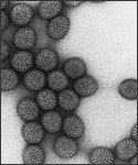 Transmission electron micrograph of rotavirus.