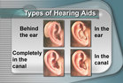 Four types of hearing aids. - Click to enlarge in new window.