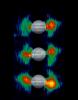 Inner Radiation Belts of Jupiter