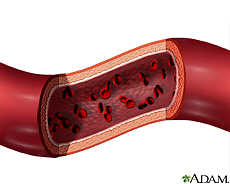 Ilustración de una arteria conteniendo glóbulos rojos