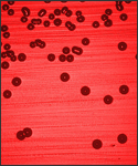 Blood agar plate culture of Haemophilus influenzae.